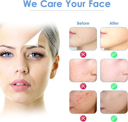 Before and after skin comparison showing acne reduction and clearer complexion.