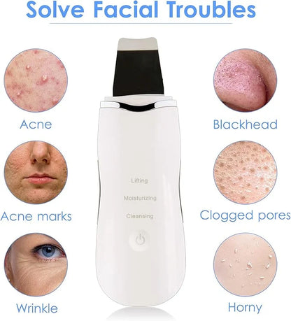 White facial skin scrubber for acne, blackheads, clogged pores and wrinkles.
